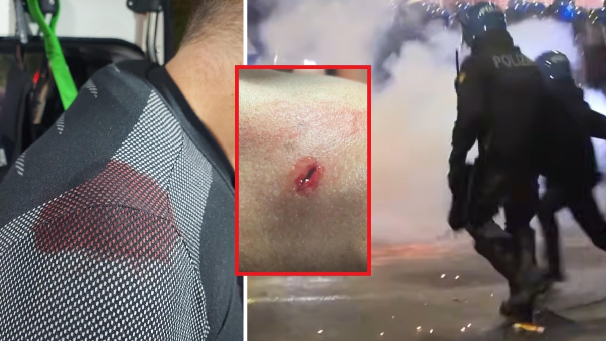 poliziotto accoltellato