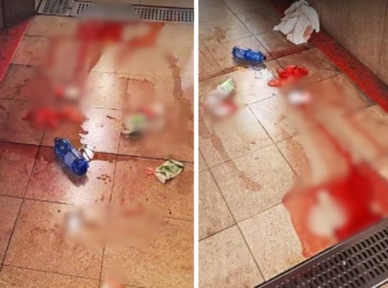 aggressione milano