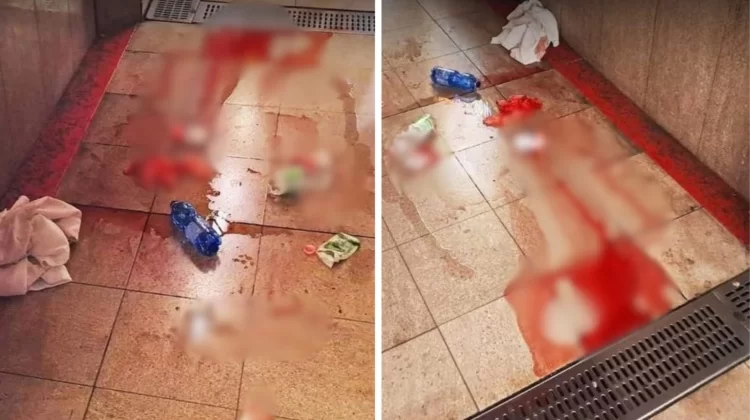 Diciamolo: la giustizia ha aiutato Saidi a sfregiare la ragazza